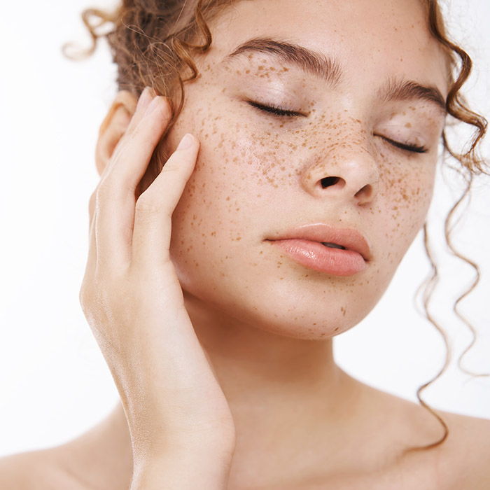 melasma1.jpg